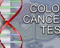 Importanța screeningului pentru cancerul colonic. Caz clinic