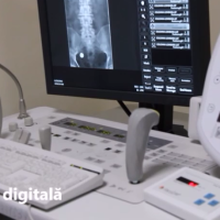 Radiologia digitala la IMSP SCM ”Sfânta Treime”