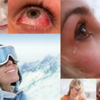 Глаза зимой: какие опасности им могут грозить